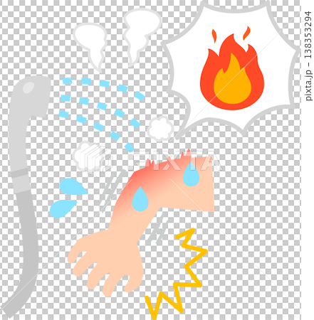 Arms after taking a shower that was too hot Arms after taking a shower that was too hot 138353294