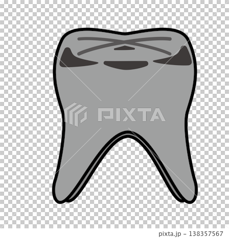 Illustration of a molar with a silver filling and decay / Dentistry and dental care Illustration of a molar with a silver filling and decay / Dentistry and dental care 138357567
