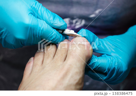 Professional Pedicure Procedure. Nail Technician Using Nail Clippers. Professional nail care service showing precise toenail cutting technique. Nail clippers. 138386475