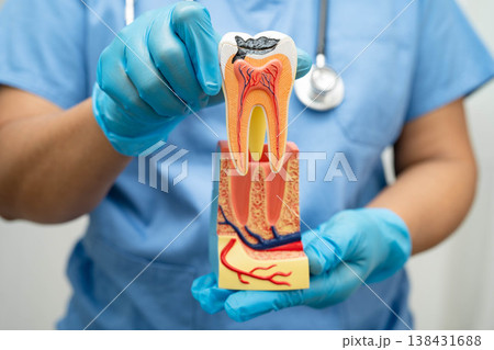 Dentist holding dental implant, artificial tooth roots into jaw, root canal of dental treatment, gum disease, teeth model for dentist. 138431688