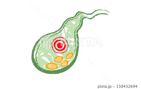 Human Gallbladder Disease 138432694