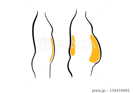 Body mass index Body mass index 138434991