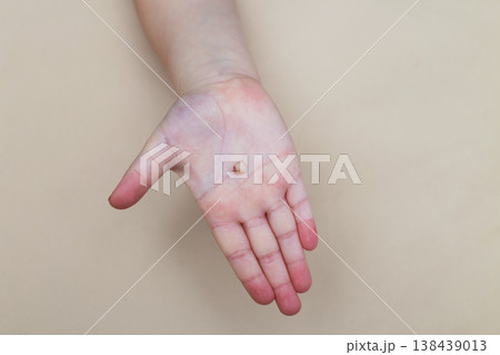 Little girl's hand holding and showing her fallen milk front tooth close up. 138439013