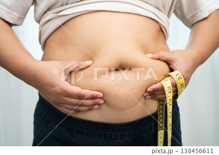 Asian woman with fat belly big size overweight and obesity with measure tape. Asian woman with fat belly big size overweight and obesity with measure tape. 138456611