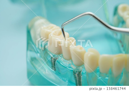 Teeth dental model with tool for dentist use to cleaning care treatment. Teeth dental model with tool for dentist use to cleaning care treatment. 138461744