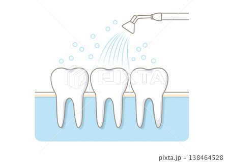 Illustration of a dental irrigator cleaning between teeth 138464528
