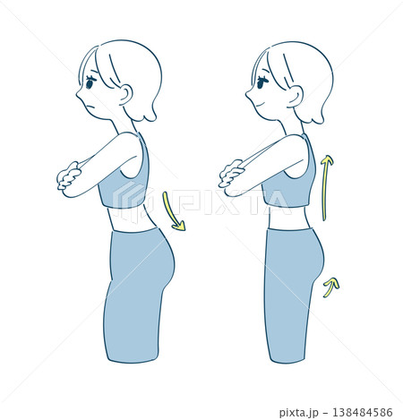 反り腰のビフォーアフターイラスト(姿勢改善・骨盤前傾・女性・横向き) 反り腰のビフォーアフターイラスト(姿勢改善・骨盤前傾・女性・横向き) 138484586