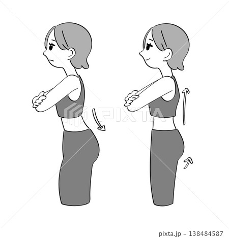 反り腰のビフォーアフターイラスト（姿勢改善・骨盤前傾・女性・横向き） 138484587