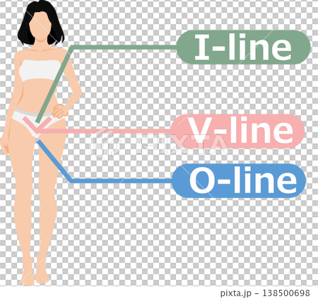 VIO脫毛示意圖 VIO脫毛示意圖 138500698