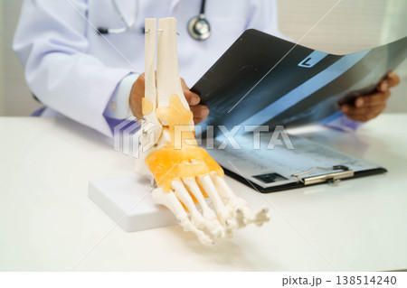 Doctor examining foot ankle joint bone radiography xray film. Doctor examining foot ankle joint bone radiography xray film. 138514240