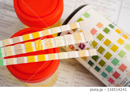 Urinalysis, urine cup with reagent strip pH paper test and comparison chart in laboratory. 138514241