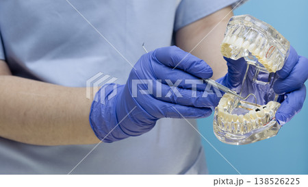 Dentist hands in blue gloves holding transparent dental typodont model and pointing at tooth decay with an explorer. Dentist hands in blue gloves holding transparent dental typodont model and pointing at tooth decay with an explorer. 138526225