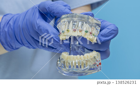 Orthodontics and bite correction concept. Doctor demonstrating colorful brackets on a transparent jaw typodont. Orthodontics and bite correction concept. Doctor demonstrating colorful brackets on a transparent jaw typodont. 138526231