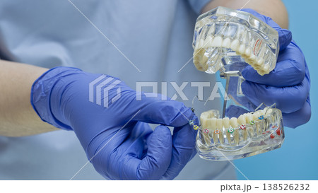 Braces installation and bite correction concept. Doctor holding clear teeth model with colorful brackets. 138526232