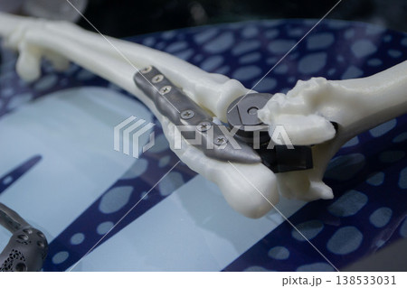 Implants and prostheses printed on 3D printer from biocompatible titanium powder. Patient-specific total endoprosthesis of elbow joint for dog on bones printed on 3D printer from plastic. Medical Implants and prostheses printed on 3D printer from biocompatible titanium powder. Patient-specific total endoprosthesis of elbow joint for dog on bones printed on 3D printer from plastic. Medical 138533031