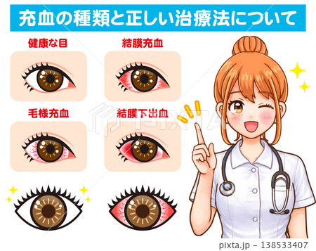 ドライアイと充血の説明をする看護師のイラスト素材 138533407