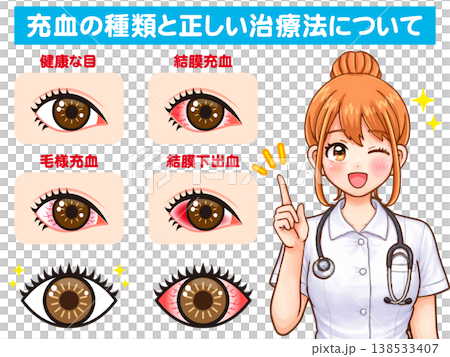 護士講解眼睛乾澀發紅的插圖 138533407