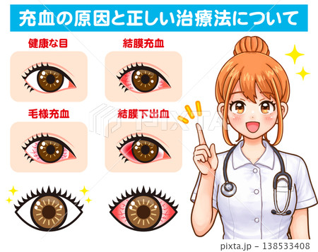 ドライアイと充血の説明をする看護師のイラスト素材2 138533408