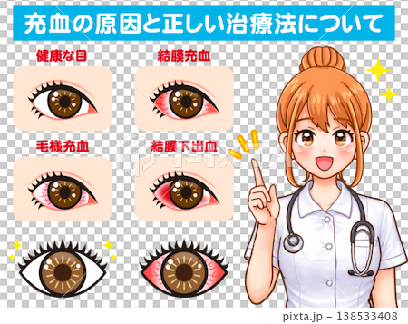 ドライアイと充血の説明をする看護師のイラスト素材2 138533408