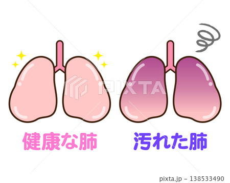 健康な肺と汚れた肺のイラスト素材3 138533490