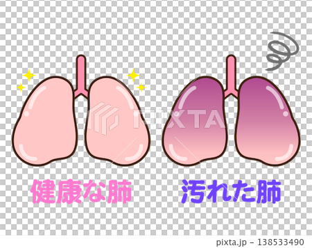 健康な肺と汚れた肺のイラスト素材3 138533490