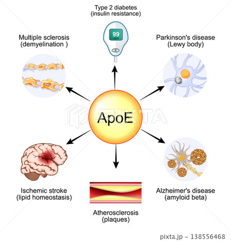 Apolipoprotein E. ApoE and Lipid homeostasis.. Apo-E protein Apolipoprotein E. ApoE and Lipid homeostasis.. Apo-E protein 138556468