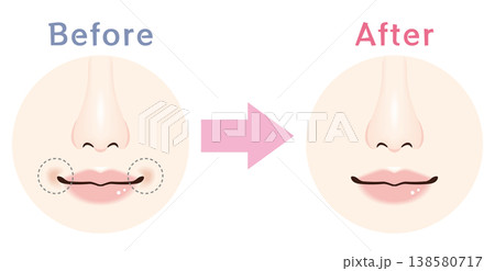 口周りのくすみ Before After イラスト 138580717