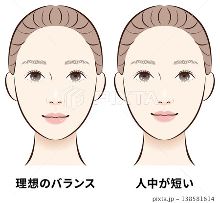 理想のバランスと人中短め 顔バランス比較図 理想のバランスと人中短め 顔バランス比較図 138581614