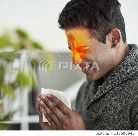 Congestion, red pain and blowing nose with a man using a tissue in his home for relief from allergies. Sick, cold or flu and a young person ill with a virus due to pollen or hay fever symptoms Congestion, red pain and blowing nose with a man using a tissue in his home for relief from allergies. Sick, cold or flu and a young person ill with a virus due to pollen or hay fever symptoms 138605945