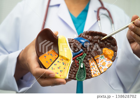 Cirrhosis, Liver cancer, fatty liver, Asian woman with liver human anatomy model. Cirrhosis, Liver cancer, fatty liver, Asian woman with liver human anatomy model. 138628702