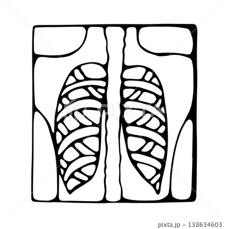 Chest x ray lungs medical radiology doodle illustration 138634603