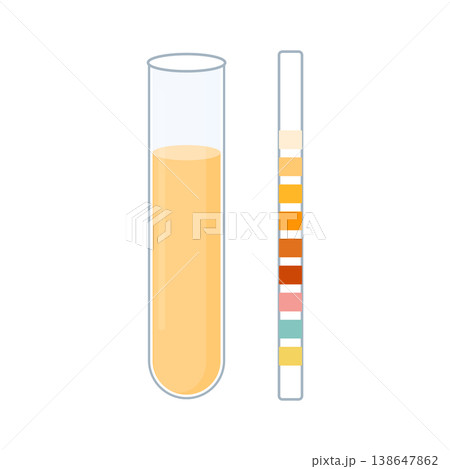 Urine sample tube and urinalysis reagent strip for kidney exam, urinary tract infection and cystitis diagnostics.  138647862