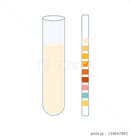 Urine sample tube and urinalysis reagent strip for kidney exam, urinary tract infection and cystitis diagnostics. Urine sample tube and urinalysis reagent strip for kidney exam, urinary tract infection and cystitis diagnostics. 138647863