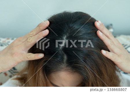 Top view of Asian women's head with new black hair growth. Top view of Asian women's head with new black hair growth. 138668807