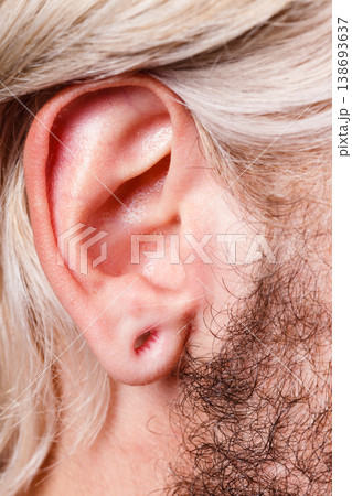 Stretched man ear after tunnel piercing Stretched man ear after tunnel piercing 138693637