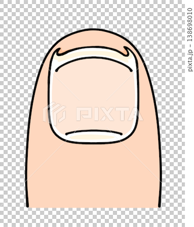 A relaxed, simple ingrown toenail treatment with solid color. 138698010