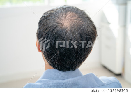 Bald in the middle head and begin no loss hair glabrous of mature Asian business smart active office man. Bald in the middle head and begin no loss hair glabrous of mature Asian business smart active office man. 138698566