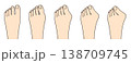 外反母趾の進行具合を比較した症状別イラスト 138709745