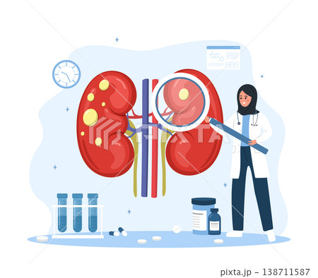 Kidney cysts concept. Female doctor with large magnifier examines kidneys. Diagnosis and treatment internal organ. Medical illustration of renal disease. Vector illustration in flat cartoon style Kidney cysts concept. Female doctor with large magnifier examines kidneys. Diagnosis and treatment internal organ. Medical illustration of renal disease. Vector illustration in flat cartoon style 138711587