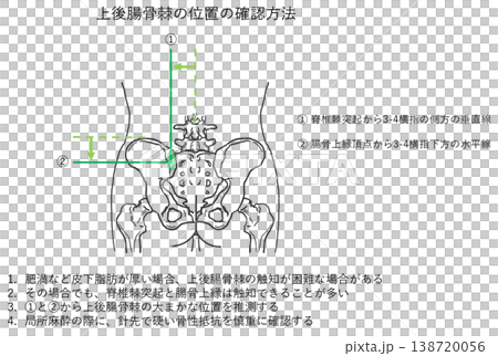 上後腸骨棘の位置の確認方法 138720056
