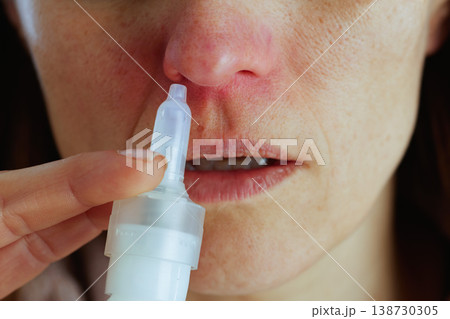 Close-Up of Woman Using Nasal Spray for Relief 138730305