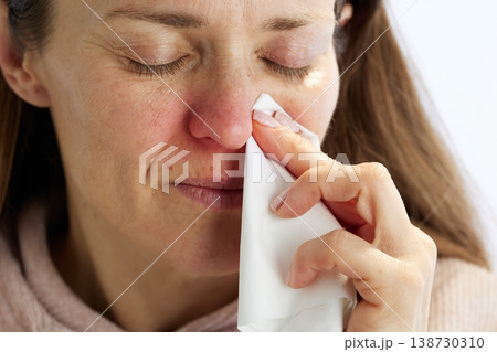 Distressed Woman Dabbing Nose with Tissue Distressed Woman Dabbing Nose with Tissue 138730310