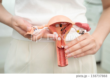 Uterus, Asian, woman holding human anatomy model. 138737868