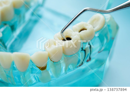 Teeth dental model with tool for dentist use to cleaning care treatment. Teeth dental model with tool for dentist use to cleaning care treatment. 138737894