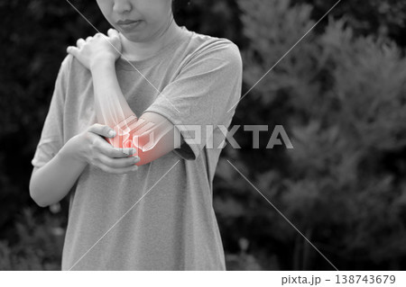 Monochrome photo of woman suffering from severe elbow pain, holding her arm with a red glowing anatomical bone graphic overlay showing joint inflammation, arthritis, or injury in medical concept. 138743679