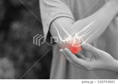 Monochrome photo of woman suffering from severe elbow pain, holding her arm with a red glowing anatomical bone graphic overlay showing joint inflammation, arthritis, or injury in medical concept. 138743681