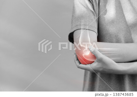 Monochrome photo of woman suffering from severe elbow pain, holding her arm with a red glowing anatomical bone graphic overlay showing joint inflammation, arthritis, or injury in medical concept. Monochrome photo of woman suffering from severe elbow pain, holding her arm with a red glowing anatomical bone graphic overlay showing joint inflammation, arthritis, or injury in medical concept. 138743685