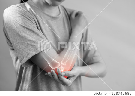 Monochrome photo of woman suffering from severe elbow pain, holding her arm with a red glowing anatomical bone graphic overlay showing joint inflammation, arthritis, or injury in medical concept. 138743686