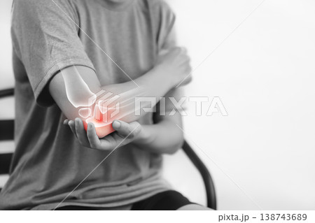 Monochrome photo of woman suffering from severe elbow pain, holding her arm with a red glowing anatomical bone graphic overlay showing joint inflammation, arthritis, or injury in medical concept. 138743689