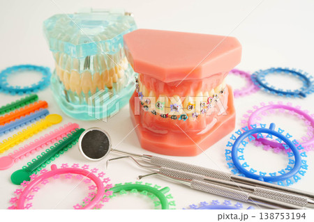 Orthodontic ligatures rings and ties, elastic rubber bands on orthodontic braces, model for dentist studying about dentistry. 138753194